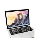 Laptop Screen Protector - Ultimate Protection - MIDI