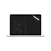 Laptop Screen Protector - Ultimate Protection - MIDI